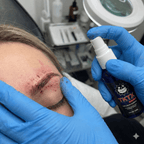 PACK 5 -TKTX SPRAY 30ml