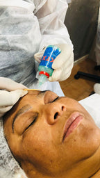 TKTX GEL 15 ml